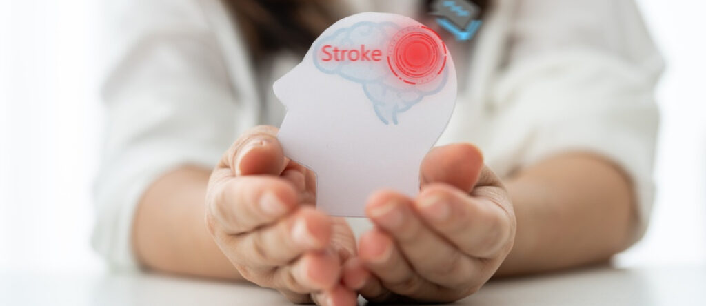 ictus santagostino sesto