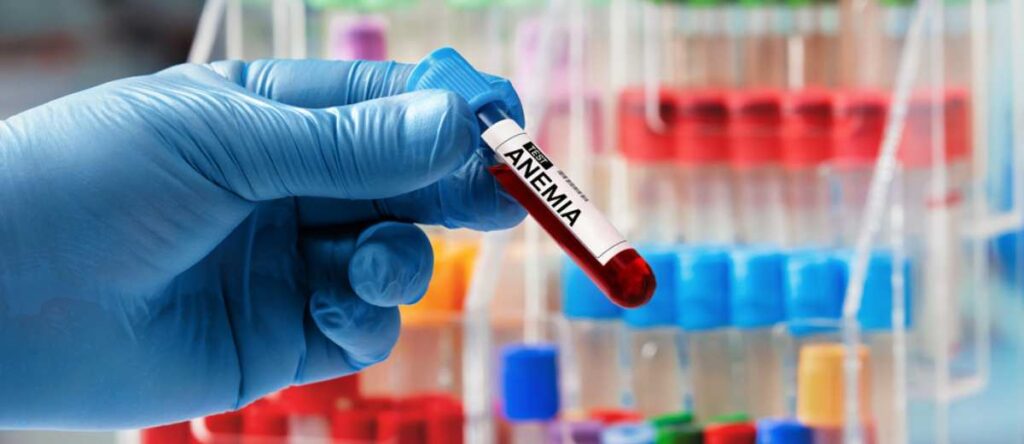 anemia sideropenica sesto