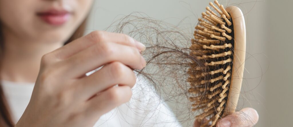 perdita capelli donne