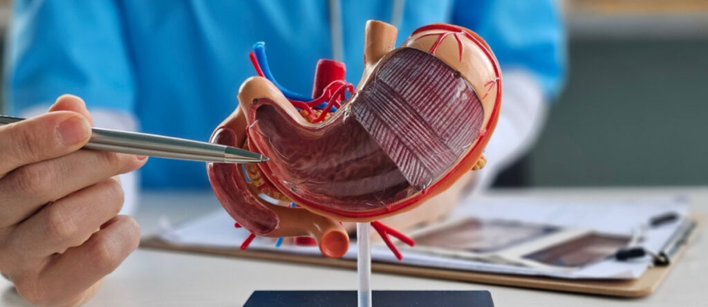 ulcera gastrica sesto