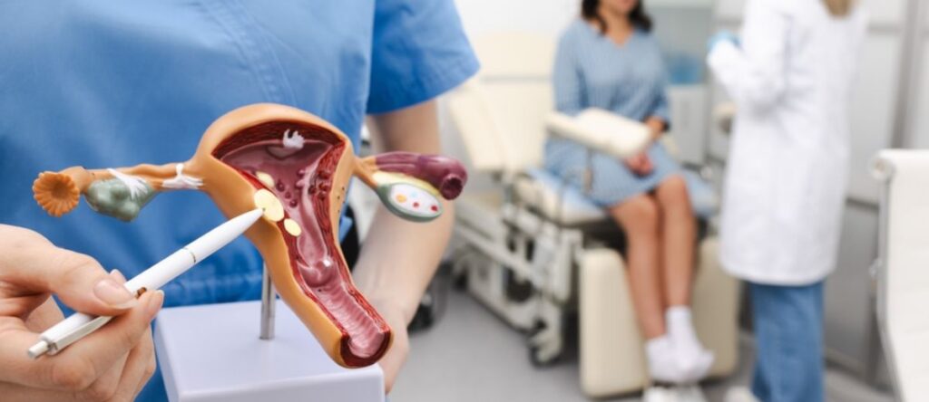 fibromi uterini sesto